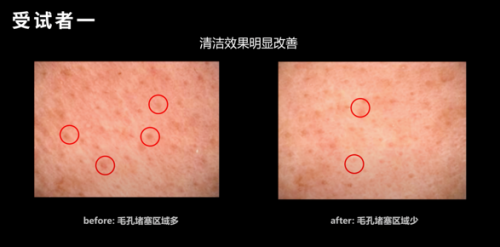 用对水，让“美”变得简单——探秘权威机构SGS 28天软水沐浴真人实验